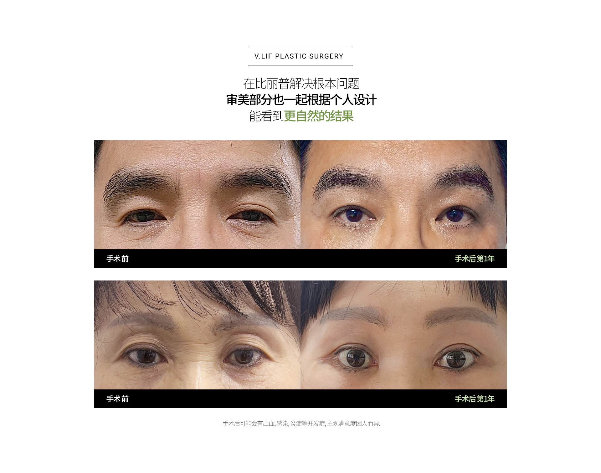 在比丽普解决根本问题 审美部分也一起根据个人设计 能看到更自然的结果 