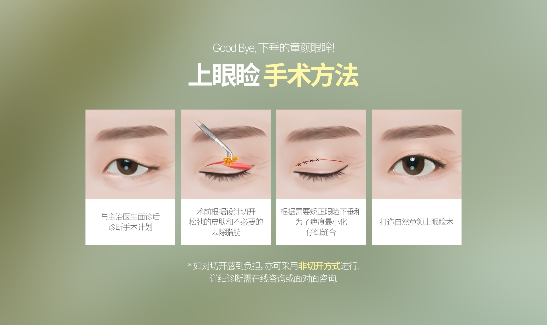 Good Bye, 下垂的童颜眼眸! 上眼睑 手术方法 与主治医生面诊后 诊断手术计划 术前根据设计切开 松弛的皮肤和不必要的 去除脂肪 根据需要矫正眼睑下垂和 为了疤痕最小化 仔细缝合 根据需要矫正眼睑下垂和 为了疤痕最小化 仔细缝合 * 如对切开感到负担，亦可采用非切开方式进行. 详细诊断需在线咨询或面对面咨询. 