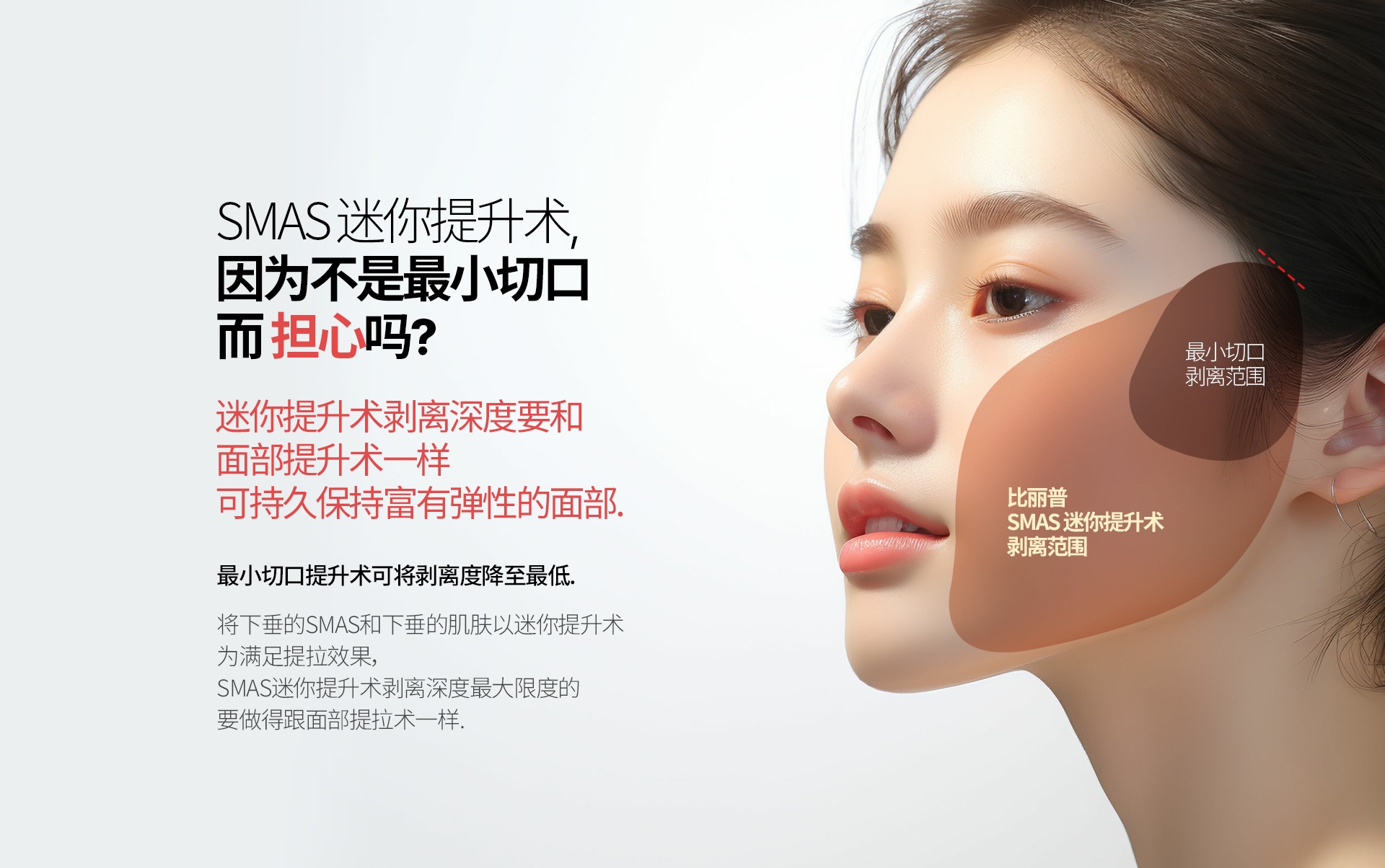 SMAS 迷你提升术, 因为不是最小切口 而 担心吗? SMAS 迷你提升术, 因为不是最小切口 而 担心吗? 最小切口提升术可将剥离度降至最低. 将下垂的SMAS和下垂的肌肤以迷你提升术 为满足提拉效果，SMAS迷你提升术剥离深度最大限度的 要做得跟面部提拉术一样. 最小切口 剥离范围 比丽普 SMAS 迷你提升术 剥离范围