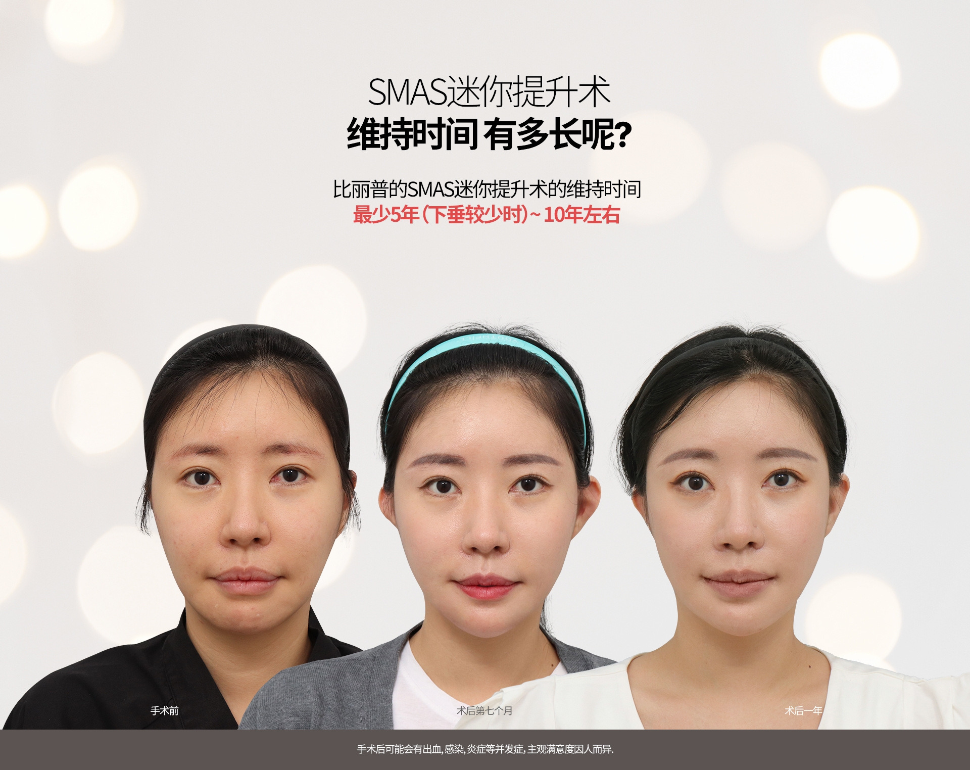 SMAS迷你提升术 维持时间 有多长呢? 比丽普的SMAS迷你提升术的维持时间 最少5年（下垂较少时）~ 10年左右 手术前 术后第七个月 术后一年 手术后可能会有出血, 感染, 炎症等并发症，主观满意度因人而异.