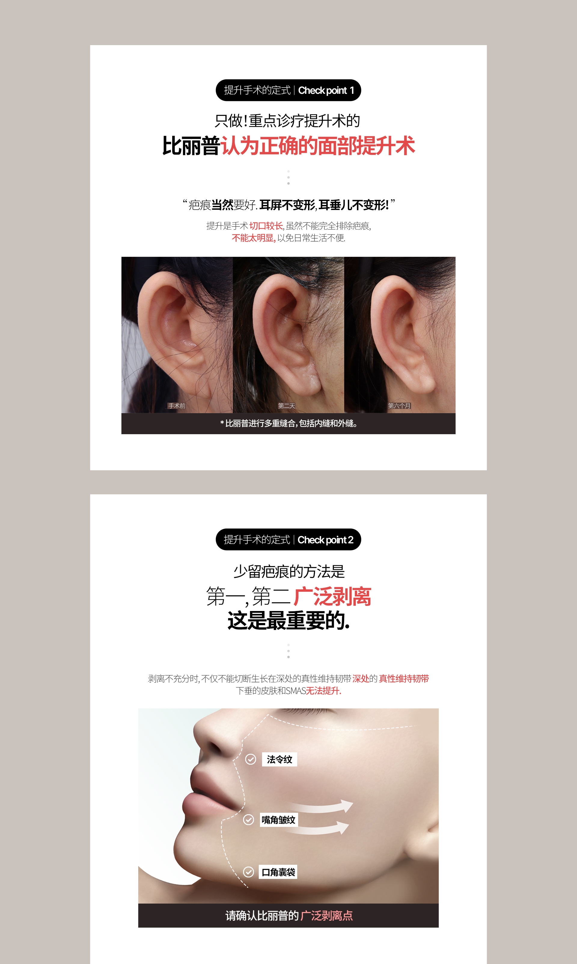 提升手术的定式  |  Check point  1  只做！重点诊疗提升术的 比丽普认为正确的面部提升术 “ 疤痕当然要好. 耳屏不变形, 耳垂儿不变形! ” 提升是手术 切口较长, 虽然不能完全排除疤痕, 不能太明显, 以免日常生活不便. 手术前 第二天 第六个月 * 比丽普进行多重缝合, 包括内缝和外缝. 提升手术的定式  |  Check point 2 少留疤痕的方法是 第一, 第二 广泛剥离 这是最重要的. 剥离不充分时, 不仅不能切断生长在深处的真性维持韧带 深处的 真性维持韧带 下垂的皮肤和SMAS无法提升. 法令纹 嘴角皱纹 口角囊袋 请确认比丽普的 广泛剥离点