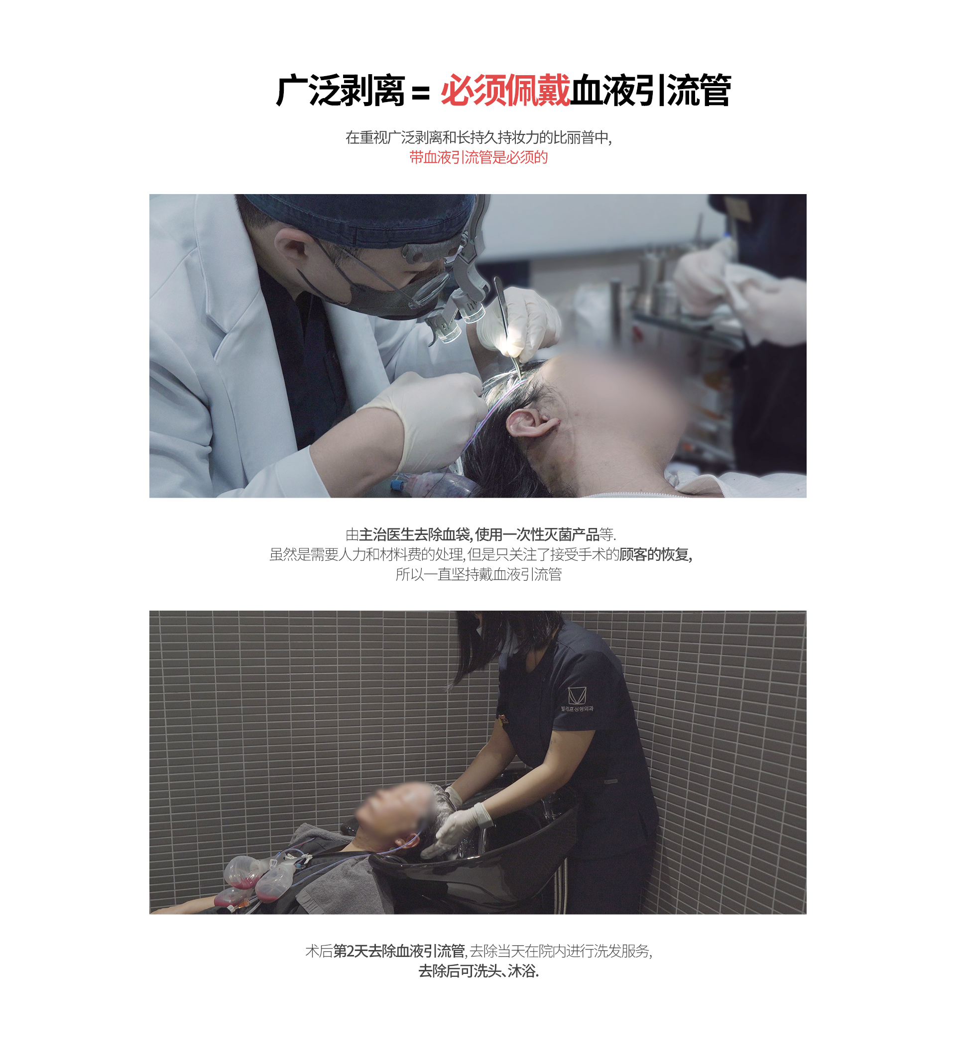 广泛剥离 =  必须佩戴血液引流管 在重视广泛剥离和长持久持妆力的比丽普中, 带血液引流管是必须的 由主治医生去除血袋, 使用一次性灭菌产品等. 虽然是需要人力和材料费的处理, 但是只关注了接受手术的顾客的恢复, 所以一直坚持戴血液引流管 术后第2天去除血液引流管, 去除当天在院内进行洗发服务, 去除后可洗头、沐浴.