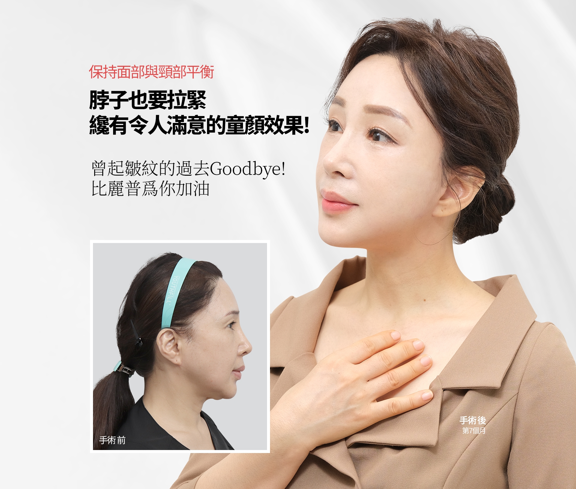 保持面部与颈部平衡 脖子也要拉紧 才有令人满意的童颜效果! 曾起皱纹的过去Goodbye!  比丽普为你加油 手术 前  手 术 后 第7个月 