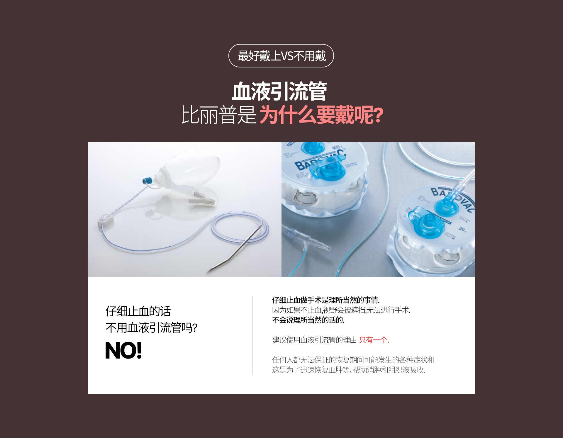 最好戴上VS不用戴 血液引流管  比丽普是 为什么要戴呢? 仔细止血的话  不用血液引流管吗? NO! 仔细止血做手术是理所当然的事情. 因为如果不止血,视野会被遮挡,无法进行手术.不会说理所当然的话的. 建议使用血液引流管的理由  只有一个. 任何人都无法保证的恢复期间可能发生的各种症状和 这是为了迅速恢复血肿等，帮助消肿和组织液吸收.