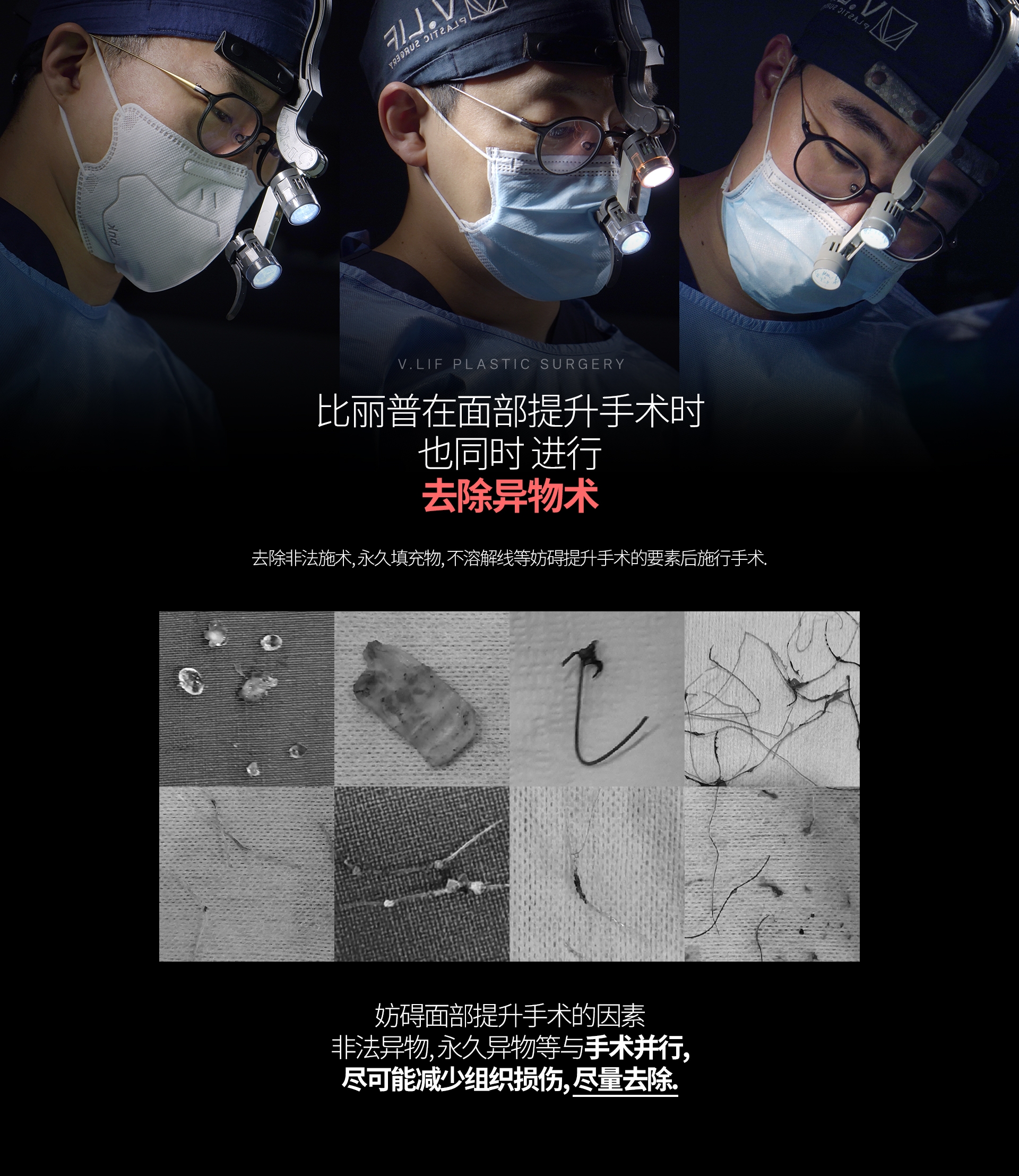 比丽普在面部提升手术时 也同时 进行 去除异物术 去除非法施术, 永久填充物, 不溶解线等妨碍提升手术的要素后施行手术. 妨碍面部提升手术的因素 非法异物, 永久异物等与手术并行, 尽可能减少组织损伤, 尽量去除.