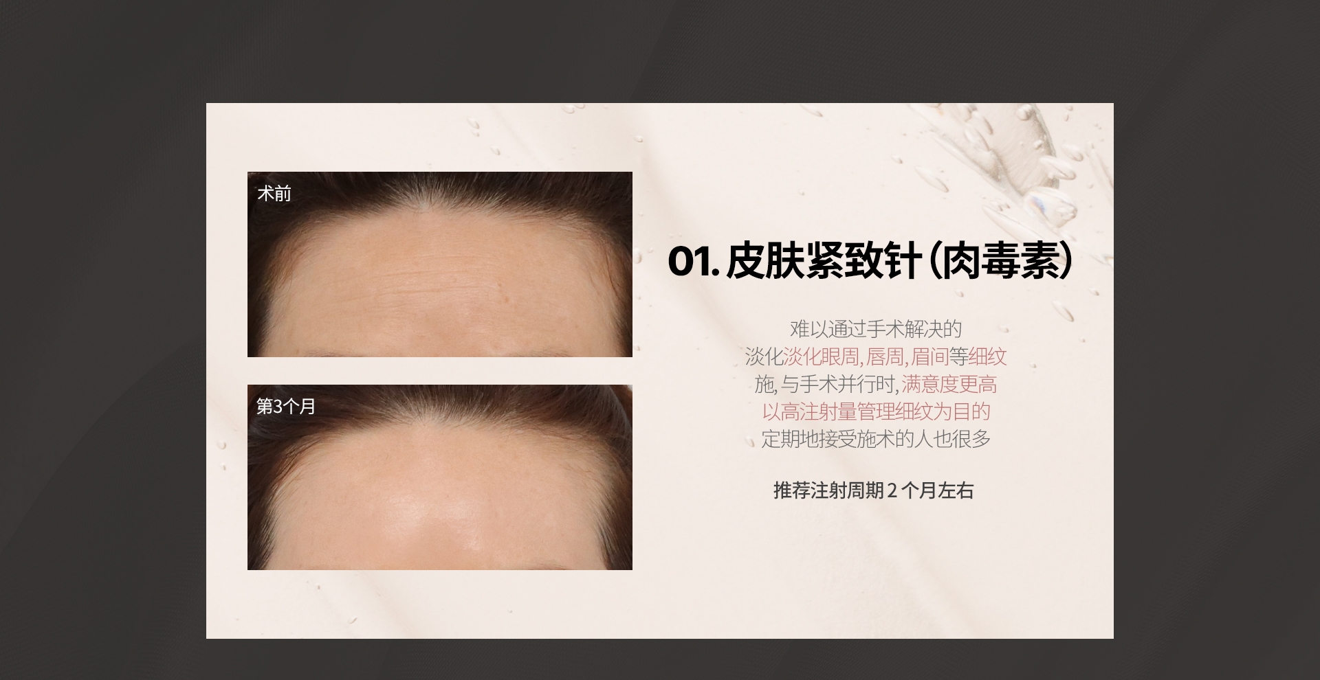 01. 皮肤紧致针（肉毒素） 难以通过手术解决的 淡化淡化眼周, 唇周, 眉间等细纹 施, 与手术并行时, 满意度更高 以高注射量管理细纹为目的 定期地接受施术的人也很多 推荐注射周期 2 个月左右 