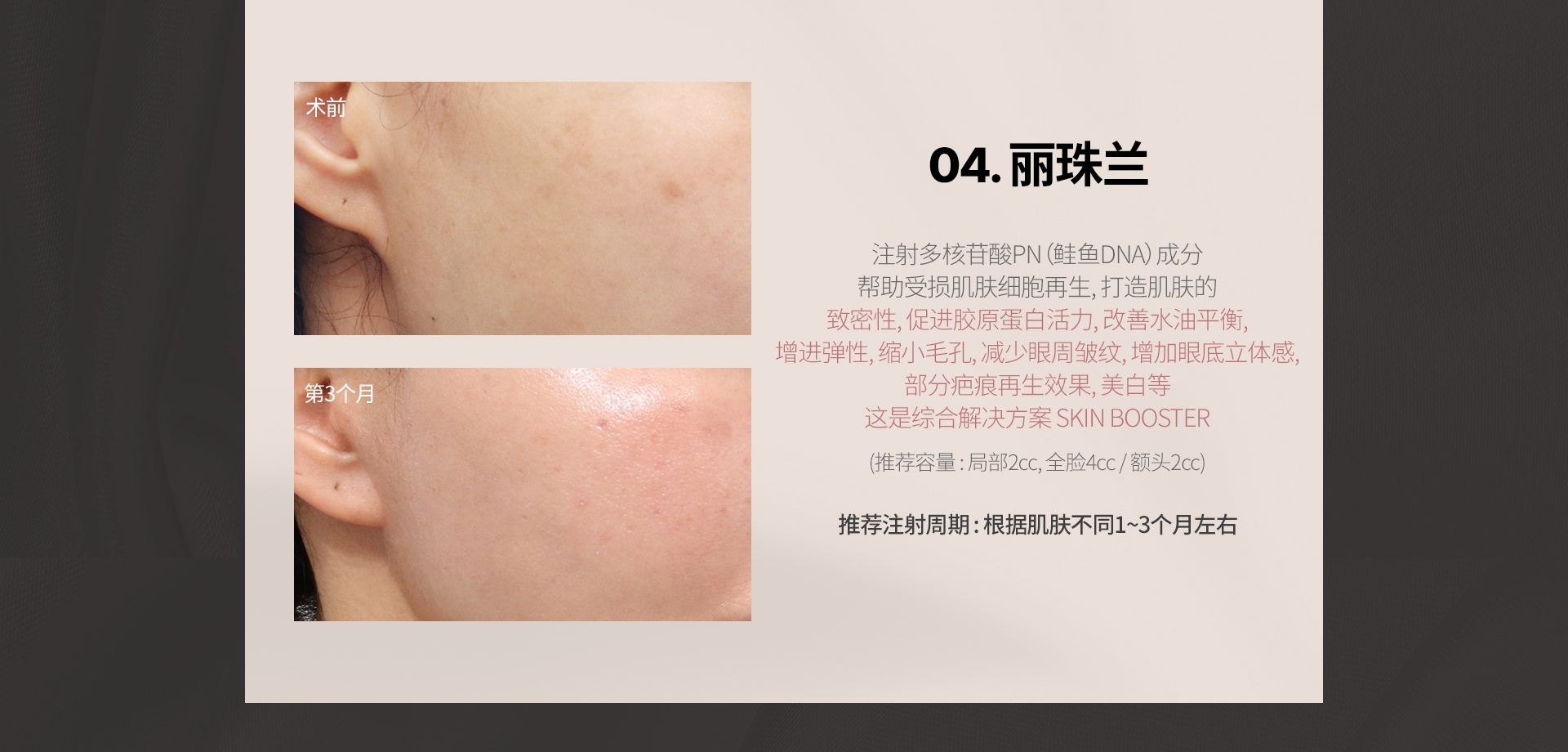 04. 丽珠兰 注射多核苷酸PN（鲑鱼DNA）成分 帮助受损肌肤细胞再生, 打造肌肤的 致密性, 促进胶原蛋白活力, 改善水油平衡, 增进弹性, 缩小毛孔, 减少眼周皱纹, 增加眼底立体感, 部分疤痕再生效果, 美白等 这是综合解决方案 SKIN BOOSTER (推荐容量 : 局部2cc, 全脸4cc / 额头2cc) 推荐注射周期 : 根据肌肤不同1~3个月左右 