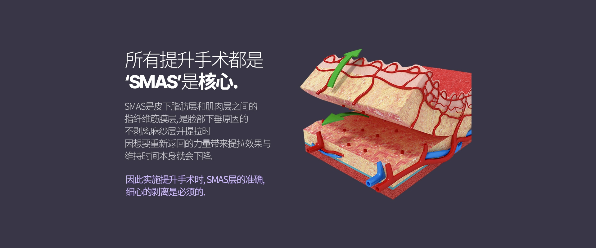所有提升手術都是 ‘SMAS’是核心. SMAS是皮下脂肪層和肌肉層之間的 指纖維筋膜層, 是臉部下垂原因的 不剝離麻紗層並提拉時 因想要重新返回的力量帶來提拉效果與 維持時間本身就會下降.  因此實施提升手術時, SMAS層的準確, 細心的剝離是必須的.