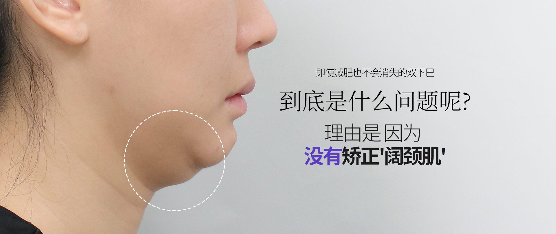 即使减肥也不会消失的双下巴 到底是什么问题呢? 理由是 因为 没有矫正'阔颈肌'