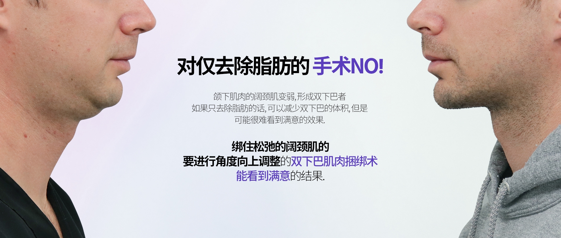 对仅去除脂肪的 手术NO! 颌下肌肉的阔颈肌变弱, 形成双下巴者 如果只去除脂肪的话, 可以减少双下巴的体积, 但是 可能很难看到满意的效果. 绑住松弛的阔颈肌的 要进行角度向上调整的双下巴肌肉捆绑术 能看到满意的结果.