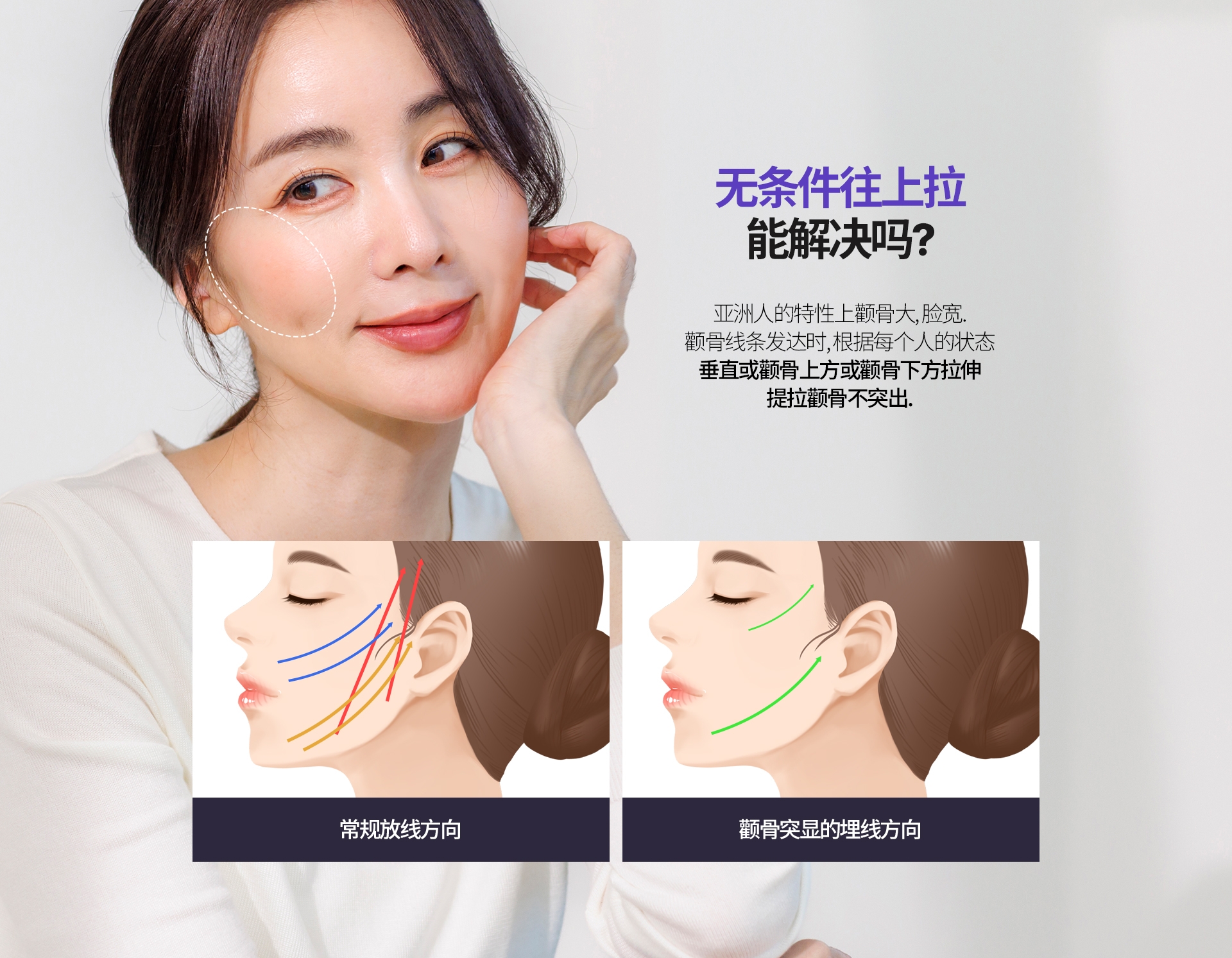 无条件往上拉 能解决吗? 亚洲人的特性上颧骨大, 脸宽. 颧骨线条发达时, 根据每个人的状态 垂直或颧骨上方或颧骨下方拉伸提拉颧骨不突出. 常规放线方向 颧骨突显的埋线方向 